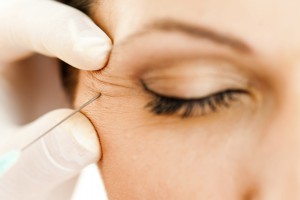 Anti-wrinkle injection at a skin clinic near Geelong