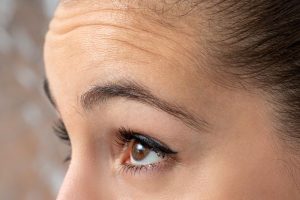 forehead lines treatment geelong